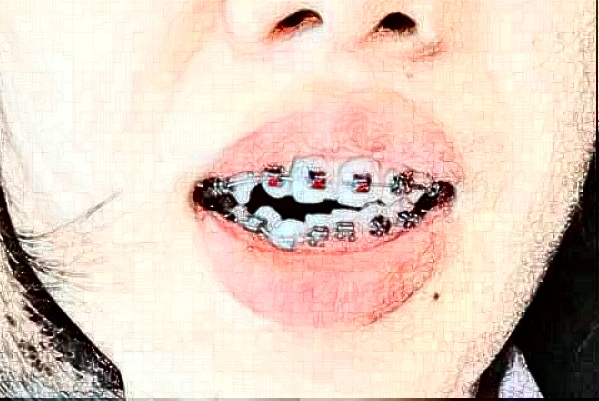 蘇州牙科醫(yī)院排行榜前五強(qiáng)揭曉!2024哪家技術(shù)好？