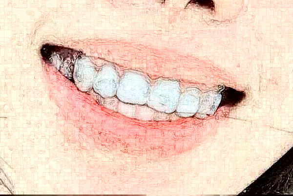 2024徐州市中心醫(yī)院補(bǔ)牙做的怎么樣_哪位醫(yī)生比較好