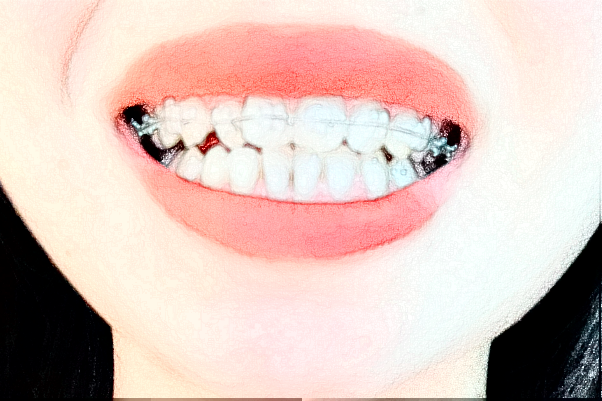 天津市口腔醫(yī)院半口種植做的好嗎？醫(yī)生排名