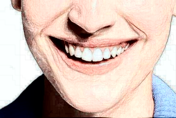 天津醫(yī)科大學口腔醫(yī)院牙齒美白價目表(價格表)_口碑怎么樣