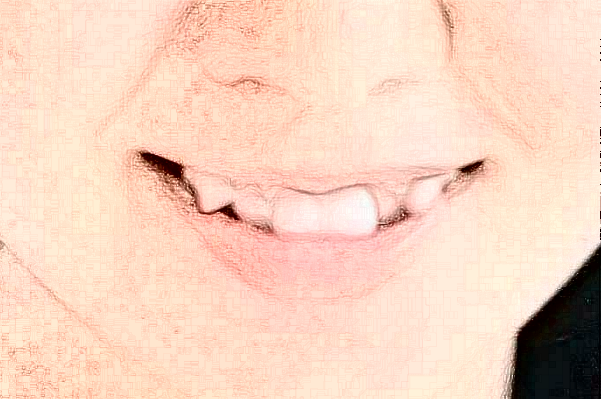 徐州市中心醫(yī)院口腔科張靜醫(yī)生技術好不好_擅長哪些項目