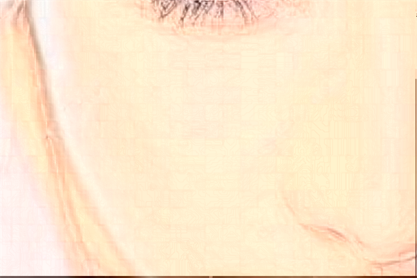 2024泉州180醫(yī)院祛疤怎么樣?激光祛疤價(jià)格多少?