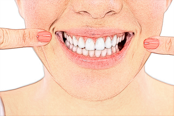 2024中山大學(xué)附屬口腔醫(yī)院牙周炎價格表?牙周炎怎么