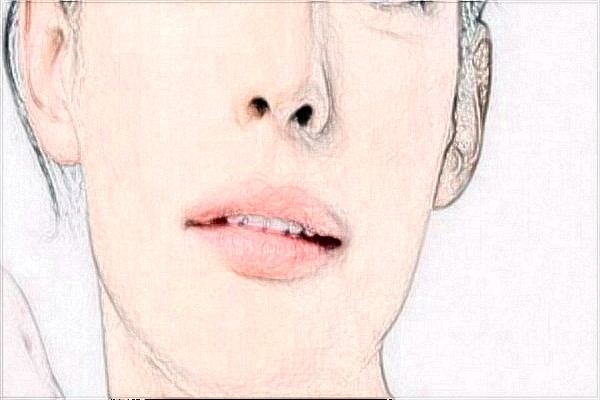 2024阜陽(yáng)市人民醫(yī)院填充做的好嗎？哪位醫(yī)生名氣大