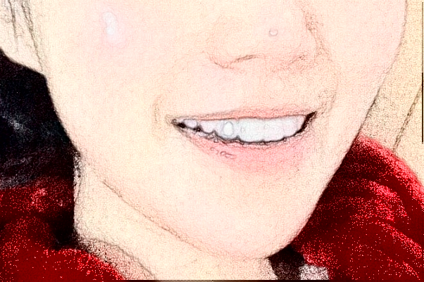 2024金華市中醫(yī)院口腔科烤瓷牙做的好嗎？哪位醫(yī)生做的好