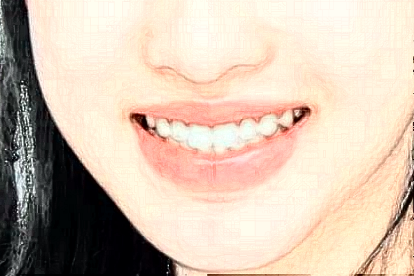 2024蘇州第四人民醫(yī)院牙齒不齊矯正怎么樣_醫(yī)生名單推薦