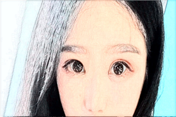 天津市第一中心醫(yī)院祛斑多少錢?祛斑日記分享