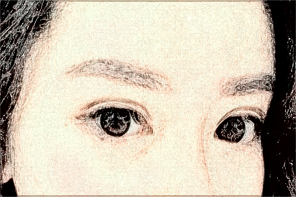 珠海市人民醫(yī)院去眼袋掛哪個醫(yī)生?去眼袋多久恢復正常