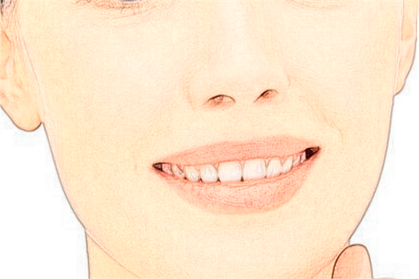 2024青島海慈醫(yī)院祛痣費用?祛痣掛什么科