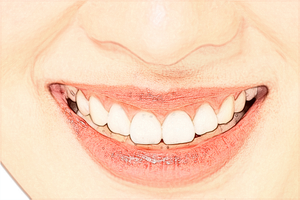 青島市口腔醫(yī)院牙齒美白哪種方法好?2024牙齒美白多少錢(qián)