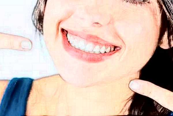 2024哈爾濱242醫(yī)院口腔科烤瓷冠做的好嗎？哪位醫(yī)生做的好