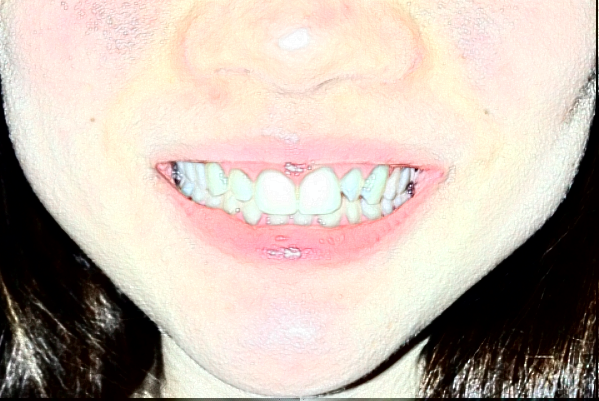 2024哈爾濱242醫(yī)院口腔科正畸做的好嗎？哪位醫(yī)生做的好