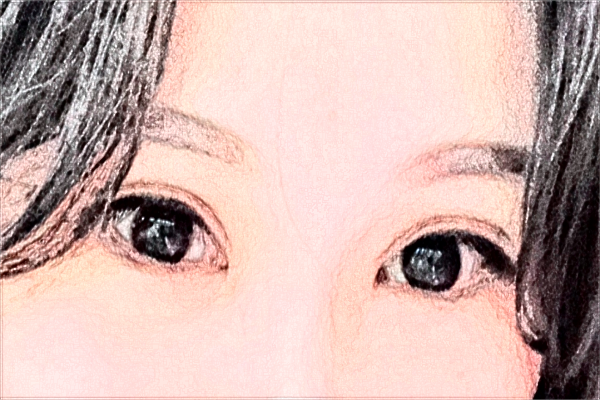 2024哈爾濱242醫(yī)院全飛秒怎么樣【案例日記分享】