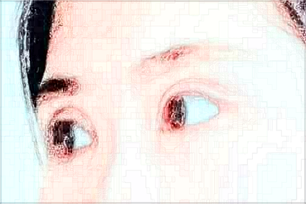 2024蘇州第四人民醫(yī)院近視手術(shù)做的好嗎？哪位醫(yī)生做的好