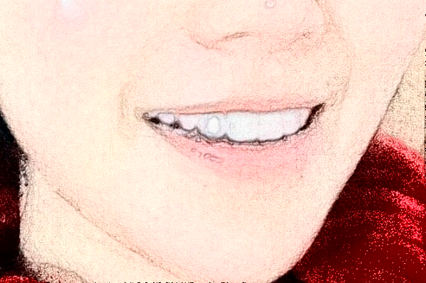 2024天津醫(yī)科大學(xué)第二醫(yī)院口腔科劉琳醫(yī)生擅長(zhǎng)怎么?技術(shù)怎么樣