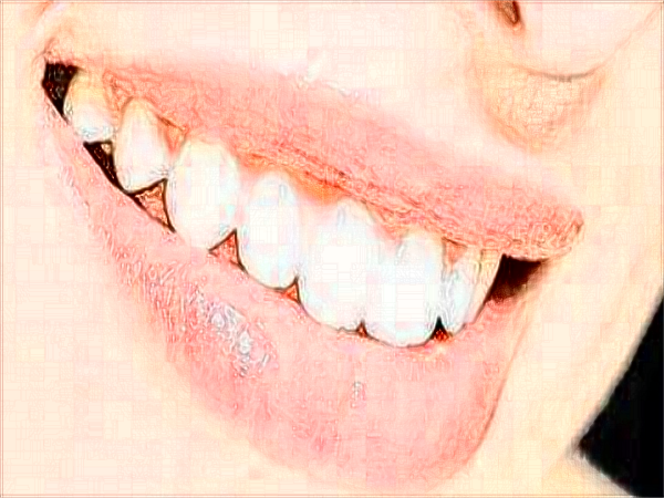 2024中山大學(xué)附屬口腔醫(yī)院洗牙多少錢?洗牙有什么好處