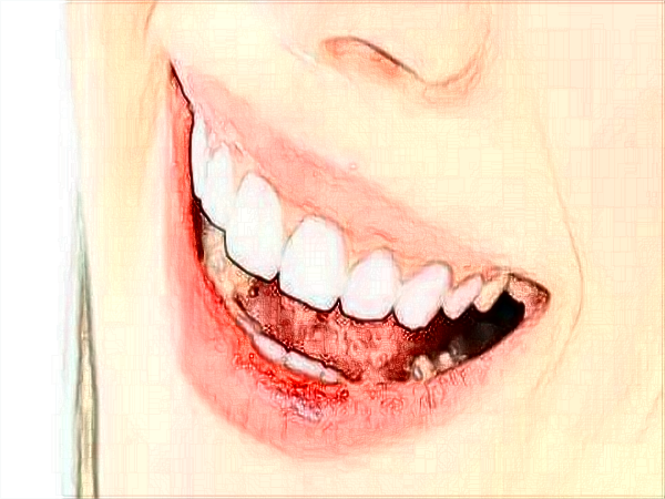 2024中山大學附屬口腔醫(yī)院牙齒矯正多少錢?牙齒矯正年齡范圍