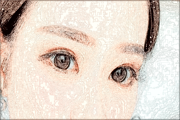 2024中山市人民醫(yī)院全飛秒手術多少錢?全飛秒手術恢復期