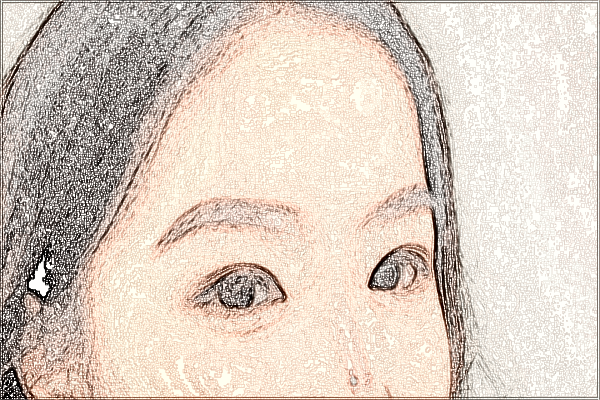 2024中山市人民醫(yī)院全飛秒激光多少錢(qián)?全飛秒激光后遺癥