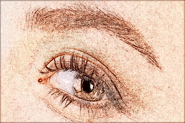 2024中山市人民醫(yī)院全飛秒激光多少錢(qián)?全飛秒激光后遺癥