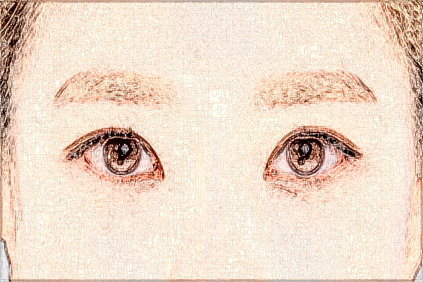 惠州市中心人民醫(yī)院做近視手術應該掛什么科?近視手術費用