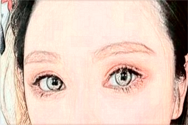 2024大連中山醫(yī)院全飛秒誰(shuí)做的好_醫(yī)生介紹