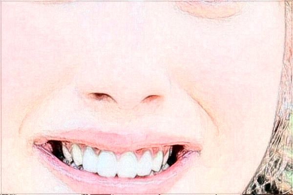 2024阜陽市人民醫(yī)院激光脫毛價格多少？做的怎么樣