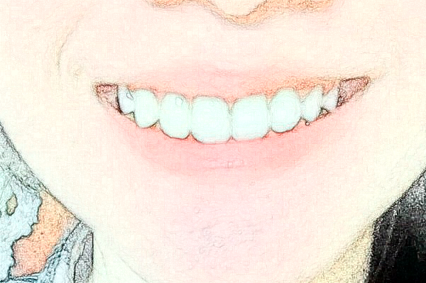 金華市中醫(yī)院口腔科牙齒修復(fù)做的好嗎？哪位醫(yī)生做的好