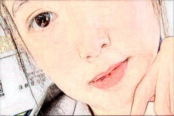 天津醫(yī)科大學第二醫(yī)院激光脫毛做的好嗎_體驗分享