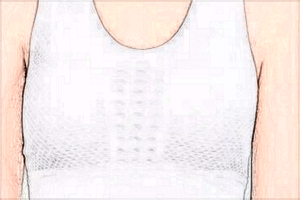 珠海市人民醫(yī)院整形外科怎么樣?整形外科包括哪些項目