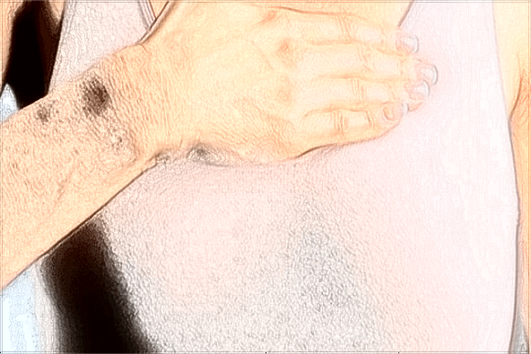 珠海市人民醫(yī)院整形外科怎么樣?整形外科包括哪些項目