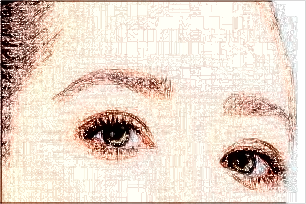 2024青島市立醫(yī)院近視眼手術(shù)費用多少?近視眼手術(shù)恢復(fù)期