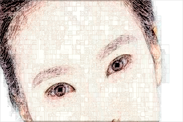 泉州180醫(yī)院激光手術(shù)怎么樣?2024激光手術(shù)治近視眼價格