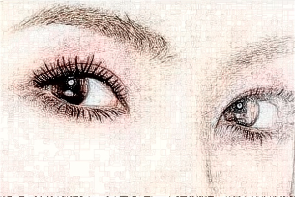 2024山東省千佛山醫(yī)院雙眼皮手術(shù)多少錢(qián)?雙眼皮手術(shù)有幾種做法