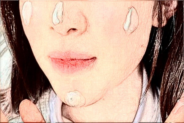 2024杭州市第一人民醫(yī)院光子嫩膚怎么樣_醫(yī)生介紹