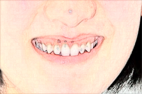 2024南京中大醫(yī)院口腔科口腔正畸做的好嗎？醫(yī)生排名