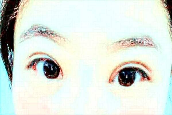 杭州市第一人民醫(yī)院近視激光手術(shù)做的怎么樣？醫(yī)生推薦