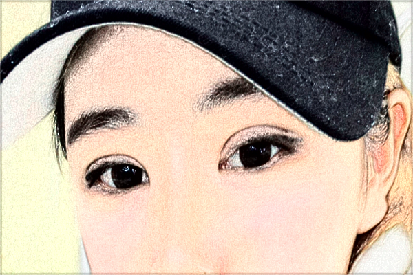 杭州市第一人民醫(yī)院近視激光手術(shù)做的怎么樣？醫(yī)生推薦