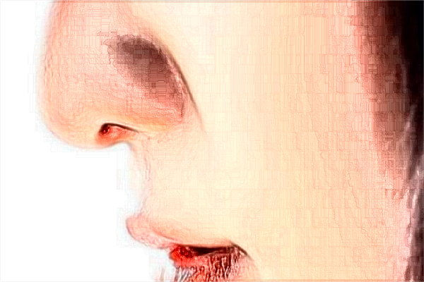 南京鼓樓醫(yī)院熱拉提做的好嗎？誰做的好