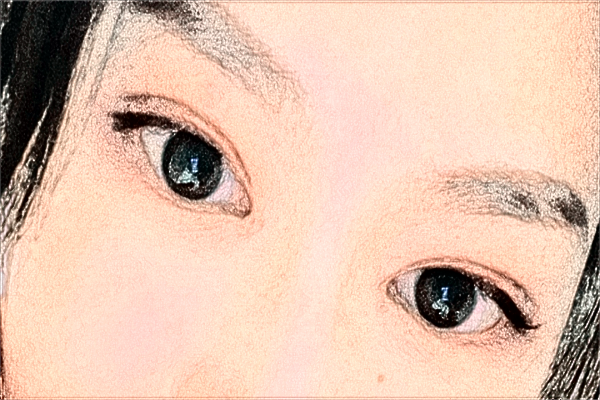 溫州醫(yī)學(xué)院附屬第一醫(yī)院做雙眼皮怎么樣_大概需要多少錢(qián)