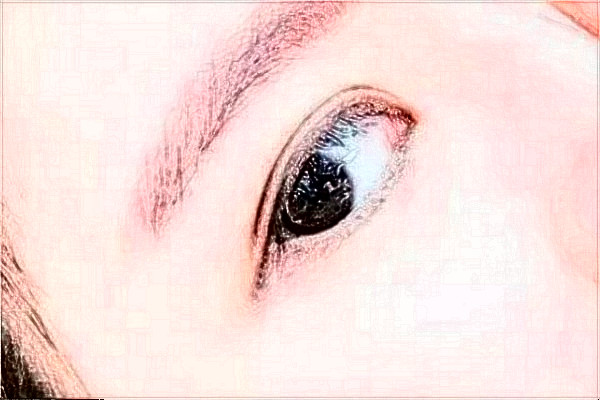 溫州醫(yī)學(xué)院附屬第一醫(yī)院做雙眼皮怎么樣_大概需要多少錢(qián)