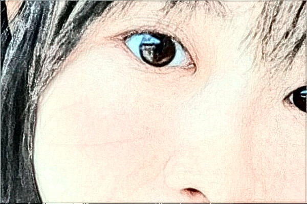 江蘇大學附屬醫(yī)院激光洗眼線怎么樣?實測案例分享