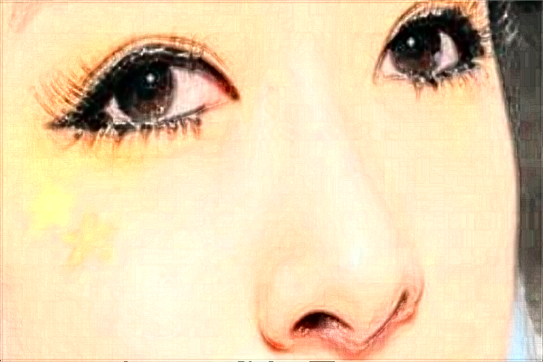 江蘇大學附屬醫(yī)院激光洗眼線怎么樣?實測案例分享