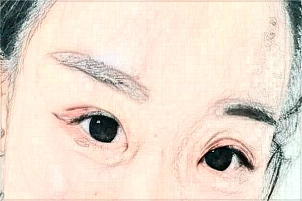 江蘇大學附屬醫(yī)院激光洗眼線怎么樣?實測案例分享