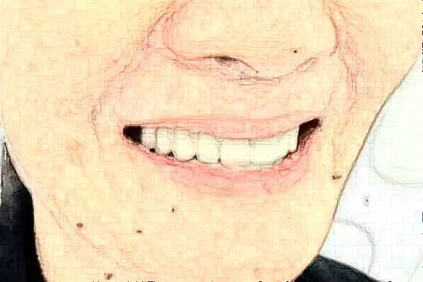 蘇州第四人民醫(yī)院正畸價(jià)目表(價(jià)格表)怎么樣