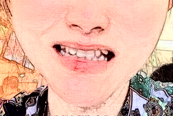 蘇州第四人民醫(yī)院正畸價(jià)目表(價(jià)格表)怎么樣