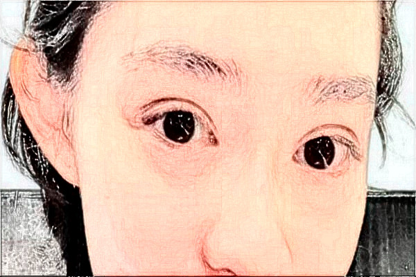 2024無錫市第一人民醫(yī)院全飛秒誰做的好?醫(yī)生推薦