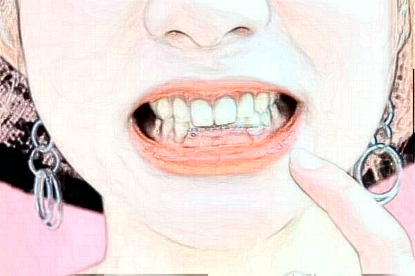 常州市第三人民醫(yī)院口腔科種植牙怎么樣_體驗(yàn)日記分享