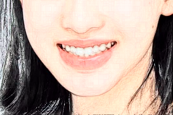 2024溫州醫(yī)學院附屬第二醫(yī)院口腔科正畸做的怎么樣_誰做的比較好