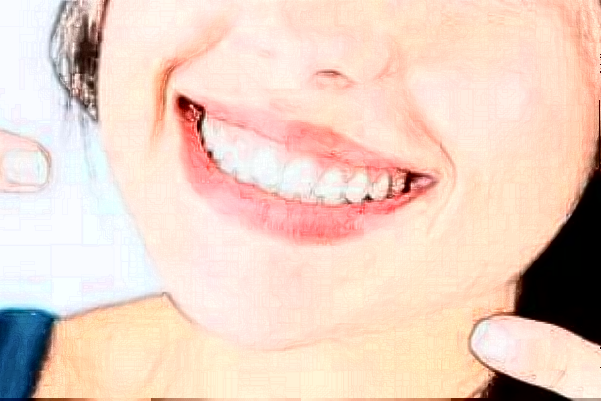 2024天津醫(yī)科大學第二醫(yī)院口腔科全瓷牙怎么樣_誰做得好